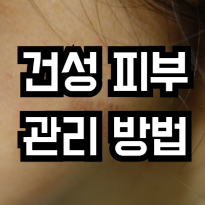 건성 피부 특징