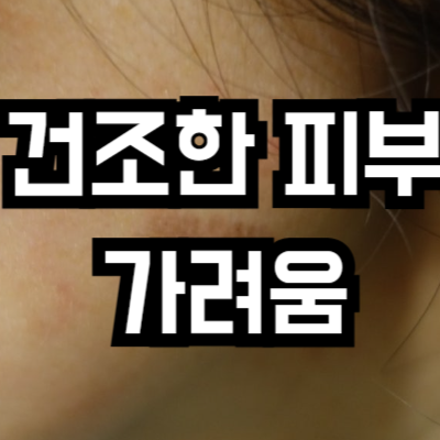 건조한 피부 가려움