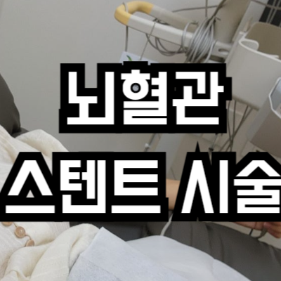 뇌혈관 스텐트 시술 비용
