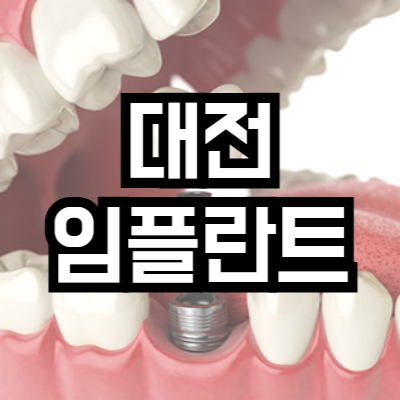 대전 임플란트 잘하는 치과