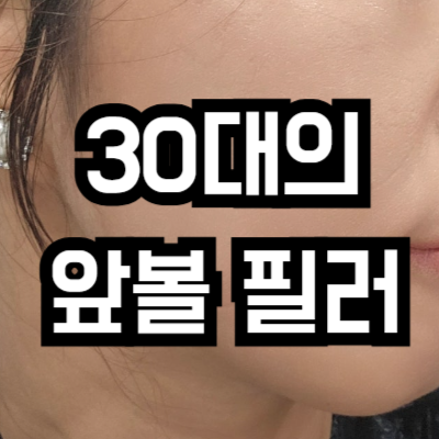 앞볼 필러 후기