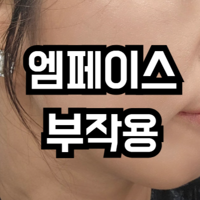 엠페이스 리프팅 부작용