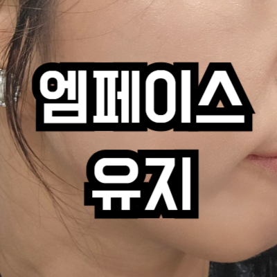 엠페이스 리프팅 유지기간