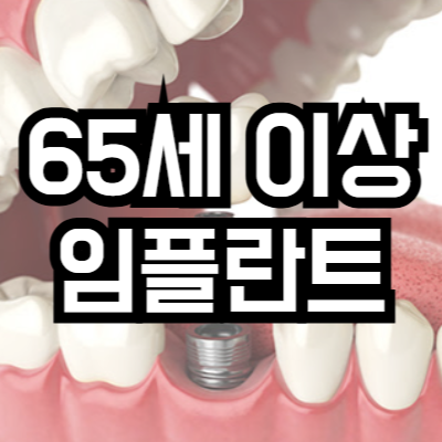 임플란트 65세 이상