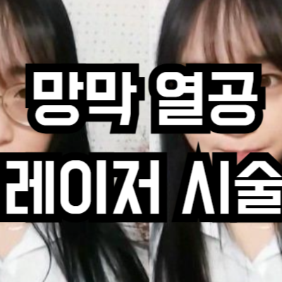 망막 열공 레이저 시술 후기