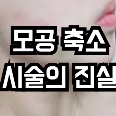 모공 축소 시술의 진실