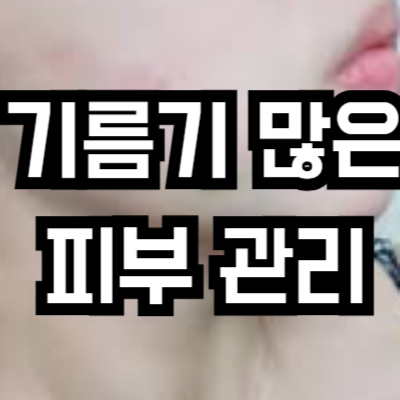 지성 피부 관리
