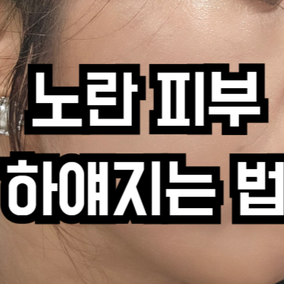 노란 피부 하얘지는 법