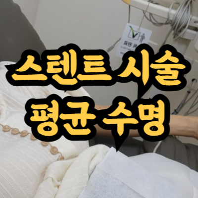 스텐트 시술 후 평균 수명