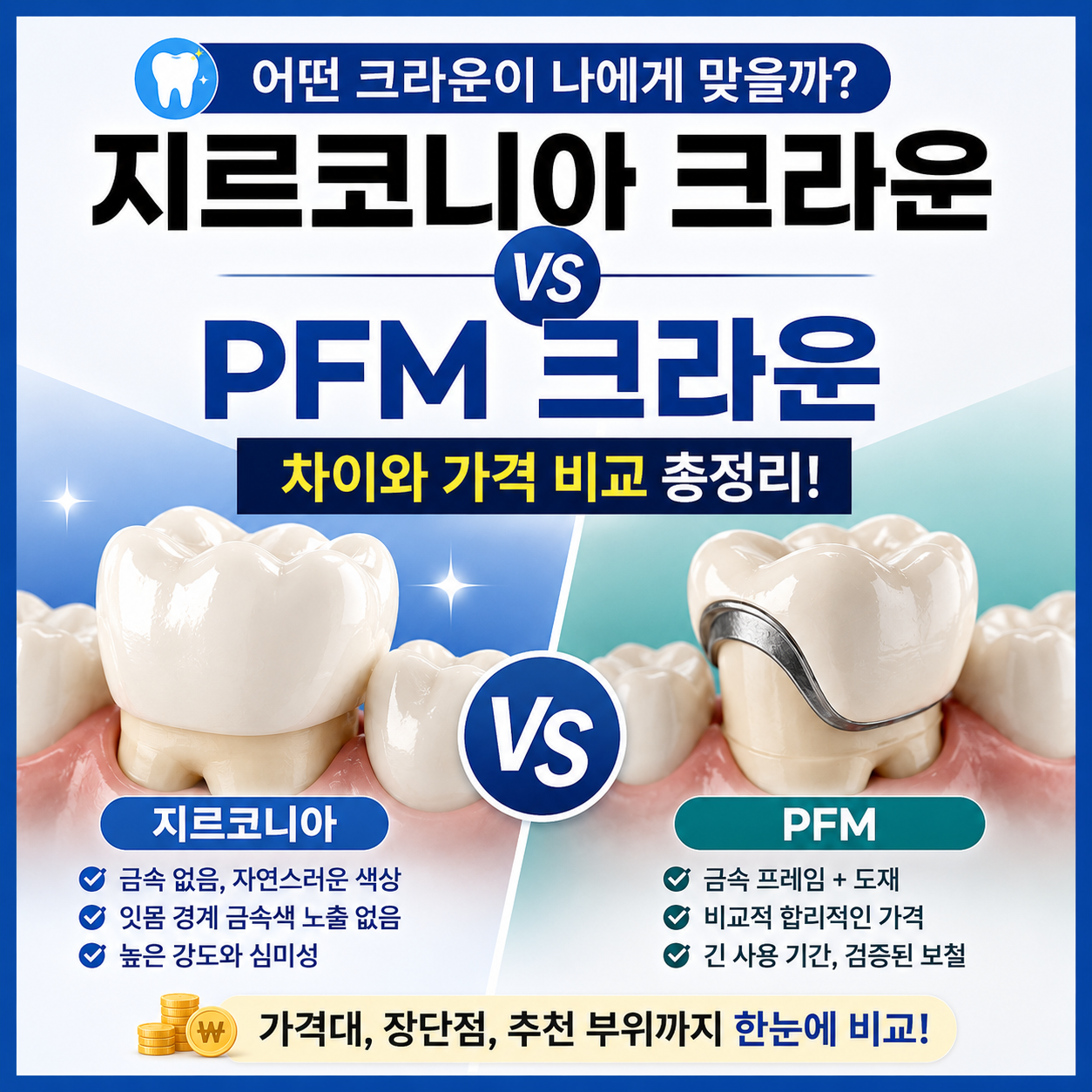 지르코니아 크라운 vs PFM 차이와 가격 비교