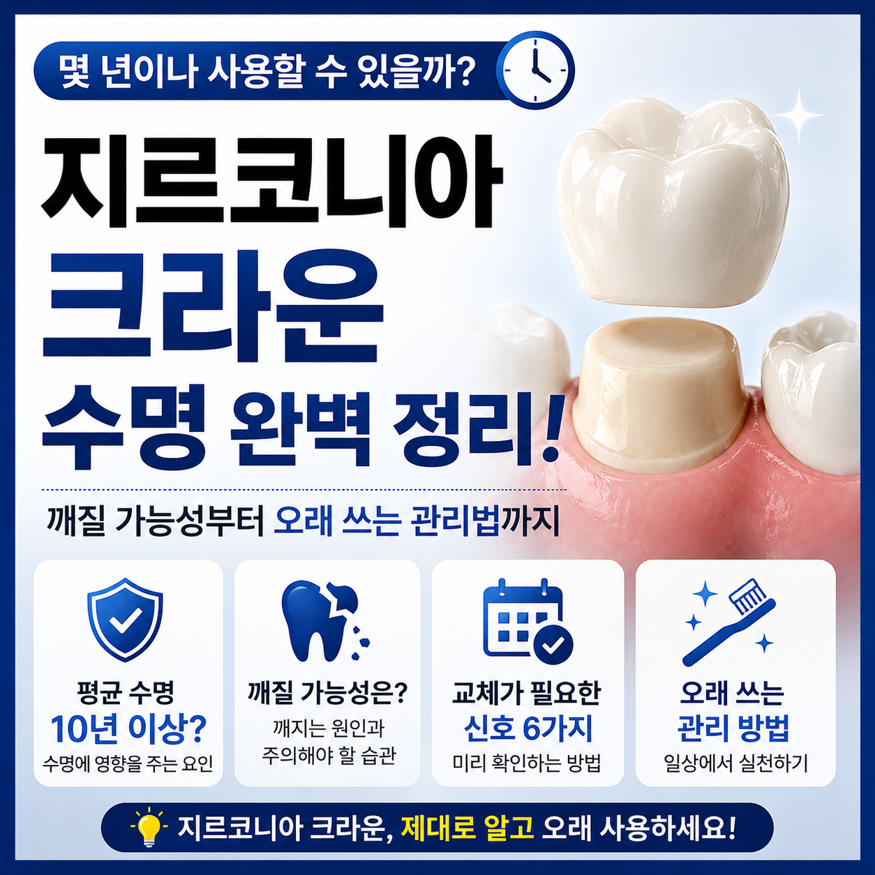 지르코니아 크라운 수명